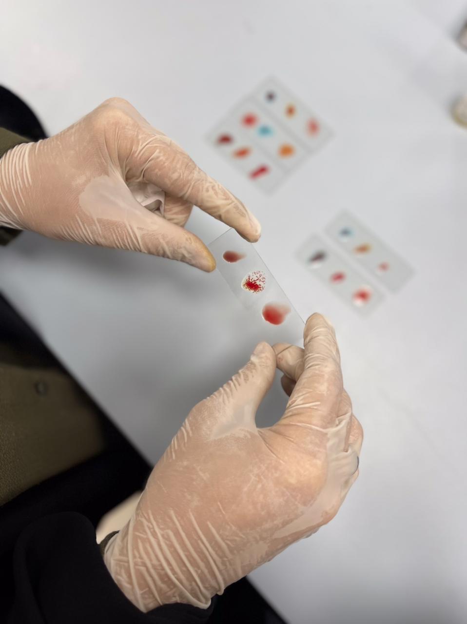 فصائل الدم وعامل ال Rh